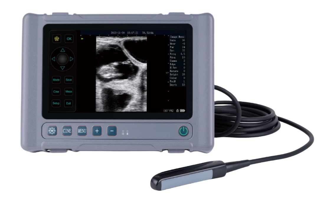 <strong><font color='#0000FF'>VT-MAX1 Full Body Waterproof Ultrasound</font></strong>